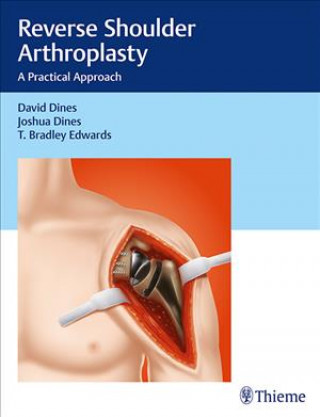 Könyv Reverse Shoulder Arthroplasty David M. Dines