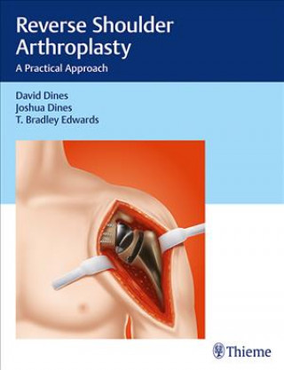 Livre Reverse Shoulder Arthroplasty David M. Dines