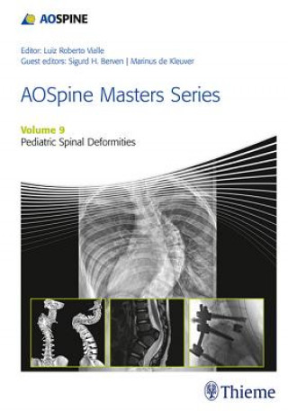 Kniha AOSpine Masters Series, Volume 9: Pediatric Spinal Deformities xyz Marinus de Kleuver