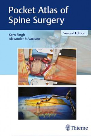 Carte Pocket Atlas of Spine Surgery Kern Singh