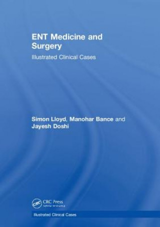 Könyv ENT Medicine and Surgery Simon Kinglsey Wickham Lloyd