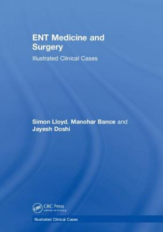 Book ENT Medicine and Surgery Simon Kinglsey Wickham Lloyd