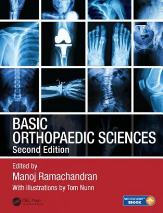 Buch Basic Orthopaedic Sciences Manoj Ramachandran