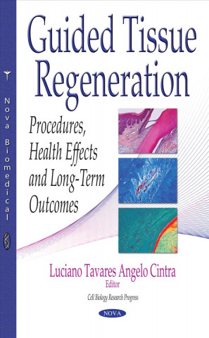Kniha Guided Tissue Regeneration 