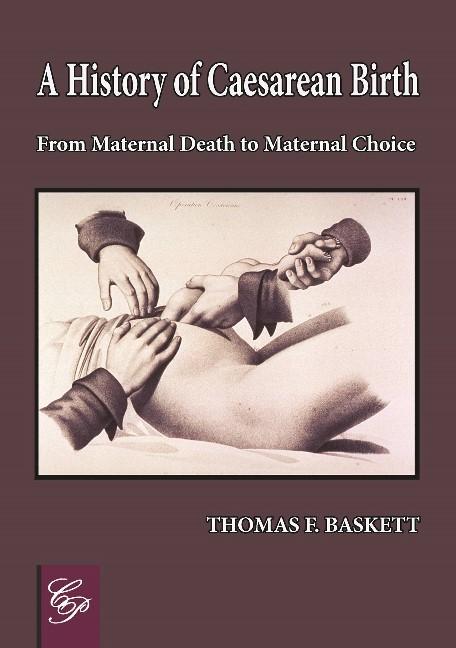 Kniha History of Caesarean Birth Thomas F. Baskett
