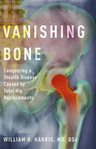 Knjiga Vanishing Bone William H. Harris