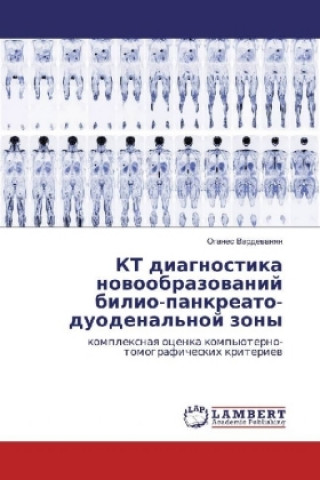 Könyv KT diagnostika novoobrazovanij bilio-pankreato-duodenal'noj zony Oganes Vardevanyan