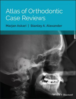 Książka Atlas of Orthodontic Case Reviews Marjan Askari