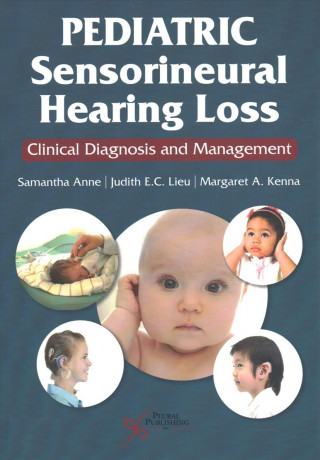 Livre Pediatric Sensorineural Hearing Loss Samantha Anne