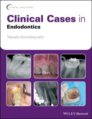 Kniha Clinical Cases in Endodontics Takashi Komabayashi