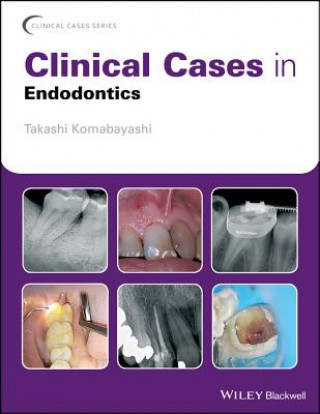 Knjiga Clinical Cases in Endodontics Takashi Komabayashi