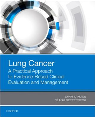 Kniha Lung Cancer: A Practical Approach to Evidence-Based Clinical Evaluation and Management Tanoue