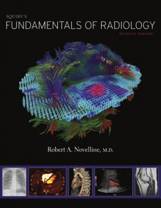 Könyv Squire's Fundamentals of Radiology Robert A. Novelline