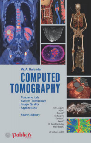 Kniha Computed Tomography Willi A. Kalender