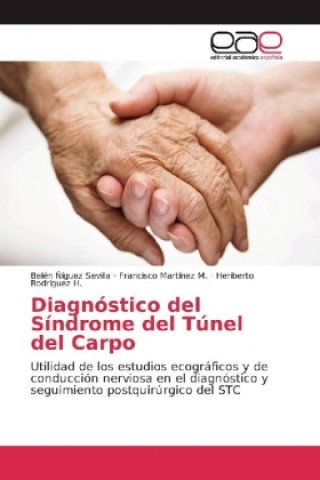 Könyv Diagnóstico del Síndrome del Túnel del Carpo Belén Ñíguez Sevilla