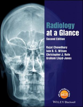 Könyv Radiology at a Glance 2e Rajat Chowdhury