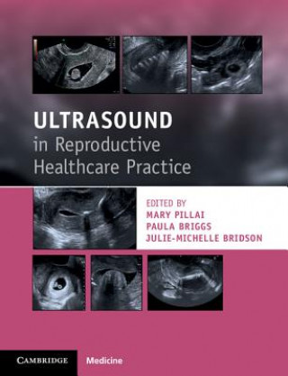 Książka Ultrasound in Reproductive Healthcare Practice Mary Pillai