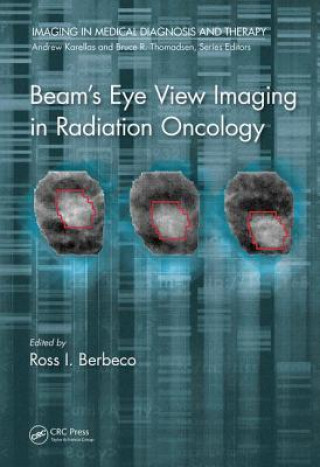 Kniha Beam's Eye View Imaging in Radiation Oncology 