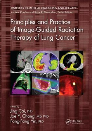 Kniha Principles and Practice of Image-Guided Radiation Therapy of Lung Cancer 