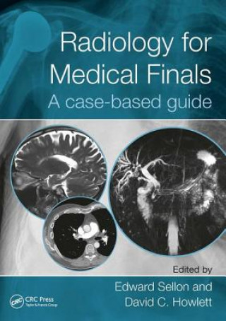 Kniha Radiology for Medical Finals Edward Sellon