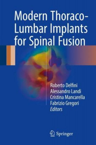 Könyv Modern Thoraco-Lumbar Implants for Spinal Fusion Roberto Delfini