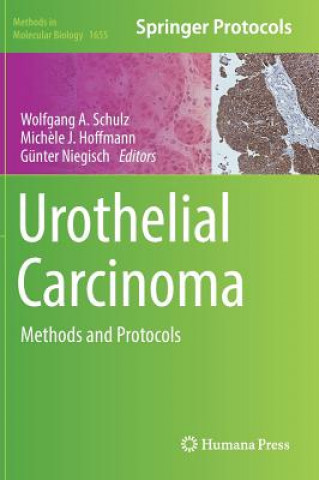 Libro Urothelial Carcinoma Wolfgang A Schulz