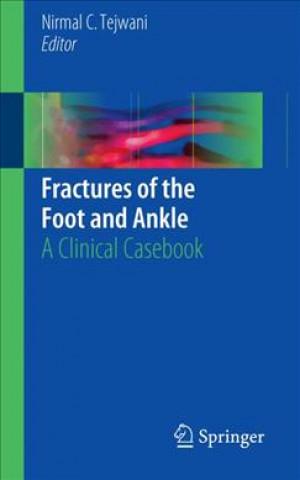 Carte Fractures of the Foot and Ankle Nirmal C. Tejwani