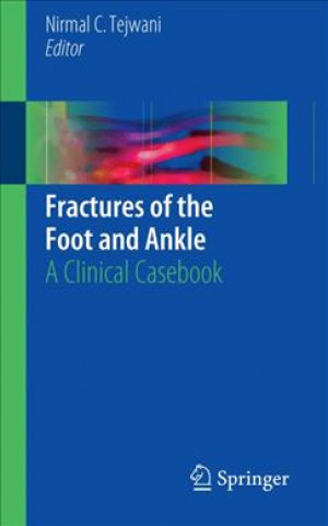 Kniha Fractures of the Foot and Ankle Nirmal C. Tejwani