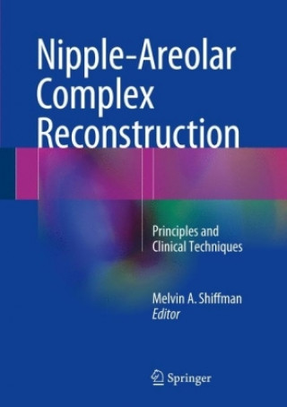 Book Nipple-Areolar Complex Reconstruction Melvin A. Shiffman