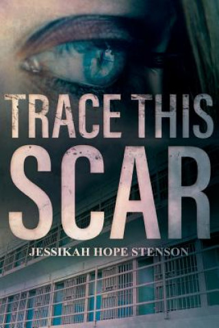 Könyv TRACE THIS SCAR Jessikah Hope Stenson