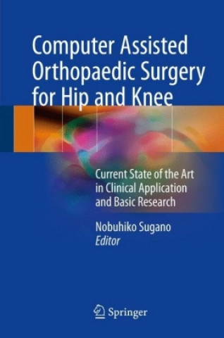 Könyv Computer Assisted Orthopaedic Surgery for Hip and Knee Nobuhiko Sugano
