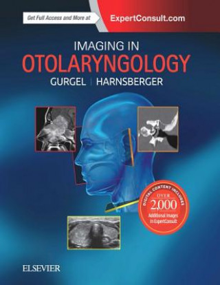 Kniha Imaging in Otolaryngology Richard K. Gurgel