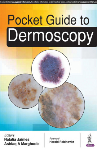 Carte Pocket Guide to Dermoscopy Natalia Jaimes