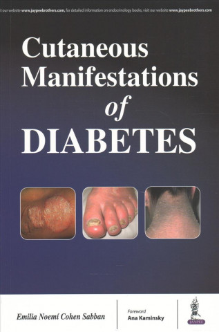 Knjiga Cutaneous Manifestations of Diabetes Sabban Cohen Emilia