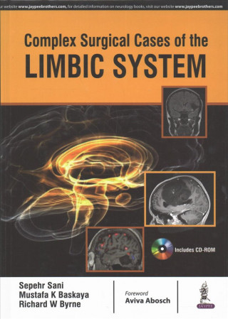 Könyv Complex Surgical Cases of the Limbic System Sepehr Sani