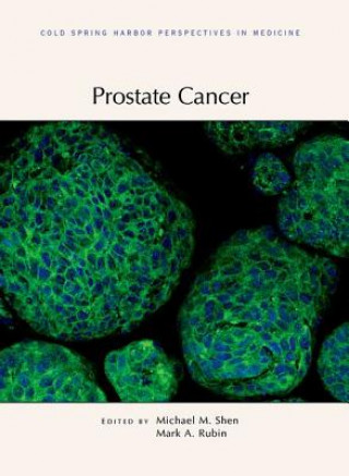 Книга Prostate Cancer Michael Shen