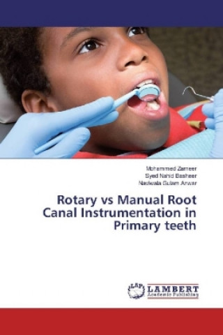 Kniha Rotary vs Manual Root Canal Instrumentation in Primary teeth Mohammed Zameer