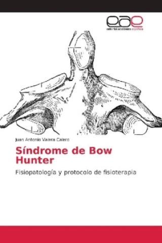 Książka Síndrome de Bow Hunter Juan Antonio Valera Calero