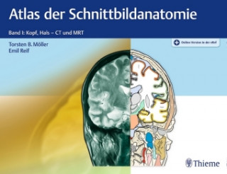 Kniha Atlas der Schnittbildanatomie. Band 01 Torsten Bert Möller