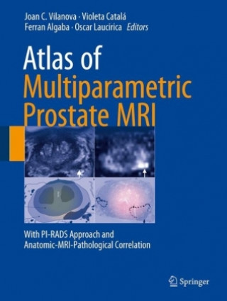 Kniha Atlas of Multiparametric Prostate MRI Joan C. Vilanova