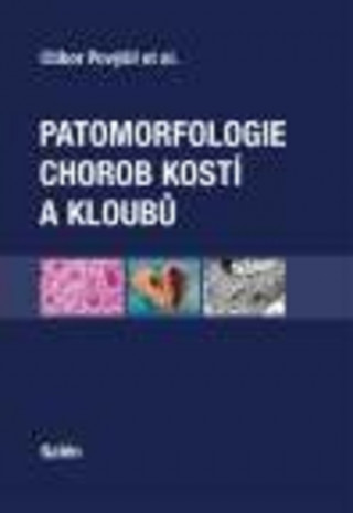 Kniha Patomorfologie chorob kostí a kloubů Ctibor Povýšil