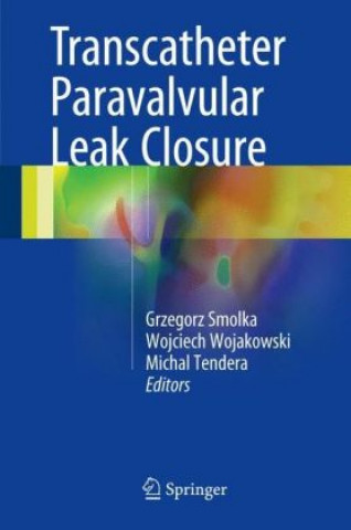 Kniha Transcatheter Paravalvular Leak Closure Grzegorz Smolka