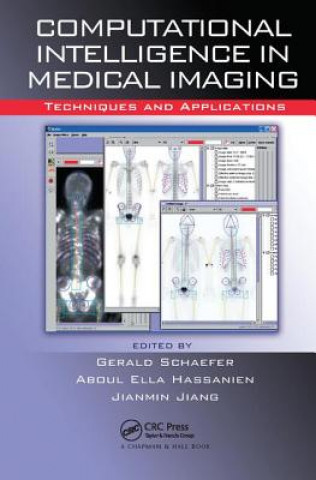 Buch Computational Intelligence in Medical Imaging 