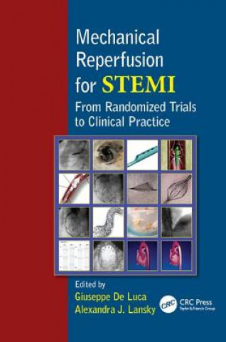 Knjiga Mechanical Reperfusion for STEMI Giuseppe de Luca