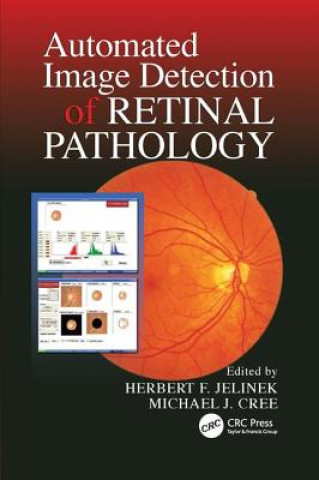 Książka Automated Image Detection of Retinal Pathology JELINEK