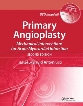 Book Primary Angioplasty 