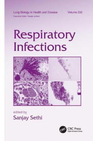 Libro Respiratory Infections Sanjay Sethi
