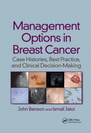 Knjiga Management Options in Breast Cancer BENSON