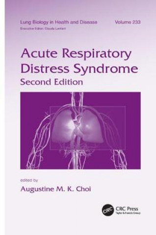Kniha Acute Respiratory Distress Syndrome 