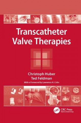 Kniha Transcatheter Valve Therapies Huber